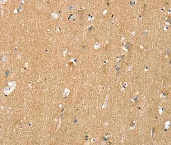 Immunohistochemistry (Formalin/PFA-fixed paraffin-embedded sections) - Anti-DR6 antibody (AB198034)