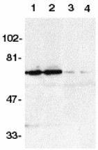Western blot - Anti-DR6 antibody (AB8417)