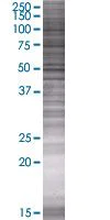 SDS-PAGE - DR6 overexpression 293T lysate (whole cell) (AB94106)