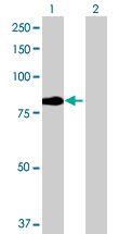 Western blot - DR6 overexpression 293T lysate (whole cell) (AB94106), expandable thumbnail