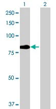 Western blot - DR6 overexpression 293T lysate (whole cell) (AB94106)
