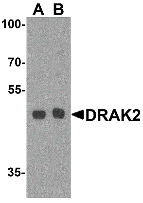 Western blot - Anti-DRAK2 antibody (AB8419)