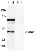 Western blot - Anti-DRAK2 antibody (AB8419)