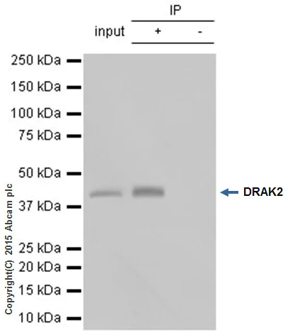 Immunoprecipitation - Anti-DRAK2 antibody [EPR3163Y] (AB108373)