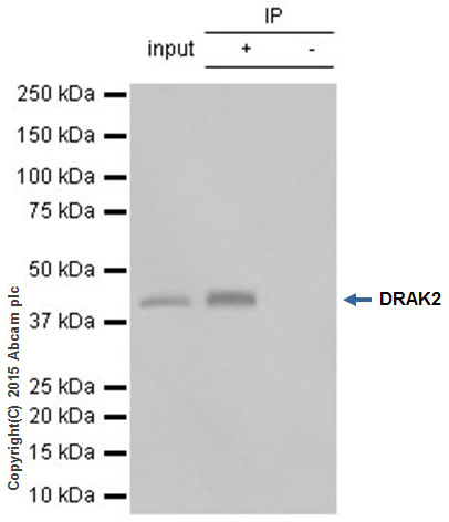 Immunoprecipitation - Anti-DRAK2 antibody [EPR3163Y] - BSA and Azide free (AB201323), expandable thumbnail