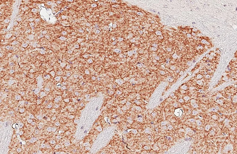 Immunohistochemistry (Formalin/PFA-fixed paraffin-embedded sections) - Anti-DRD2 antibody [HL3159] - BSA and Azide free (AB325851)