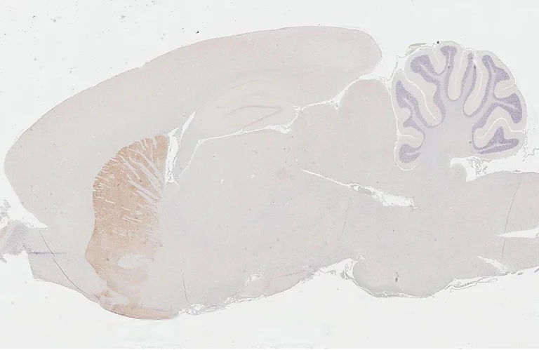 Immunohistochemistry (Formalin/PFA-fixed paraffin-embedded sections) - Anti-DRD2 antibody [HL3159] - BSA and Azide free (AB325851)