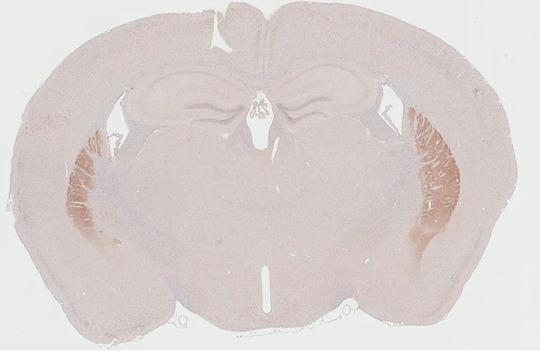 Immunohistochemistry (Formalin/PFA-fixed paraffin-embedded sections) - Anti-DRD2 antibody [HL3159] - BSA and Azide free (AB325851)