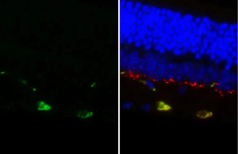 Immunohistochemistry (Formalin/PFA-fixed paraffin-embedded sections) - Anti-DRD2 antibody [HL3159] - BSA and Azide free (AB325851)