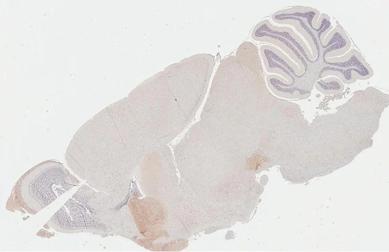Immunohistochemistry (Formalin/PFA-fixed paraffin-embedded sections) - Anti-DRD2 antibody [HL3159] - BSA and Azide free (AB325851)