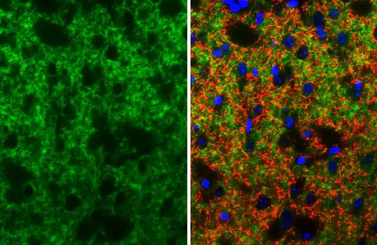 Immunohistochemistry (Formalin/PFA-fixed paraffin-embedded sections) - Anti-DRD2 antibody [HL3159] - BSA and Azide free (AB325851)