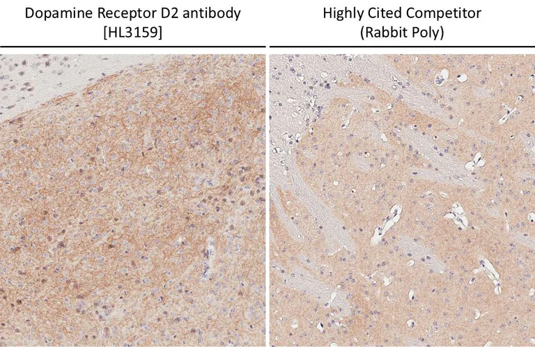 Immunohistochemistry (Formalin/PFA-fixed paraffin-embedded sections) - Anti-DRD2 antibody [HL3159] - BSA and Azide free (AB325851)