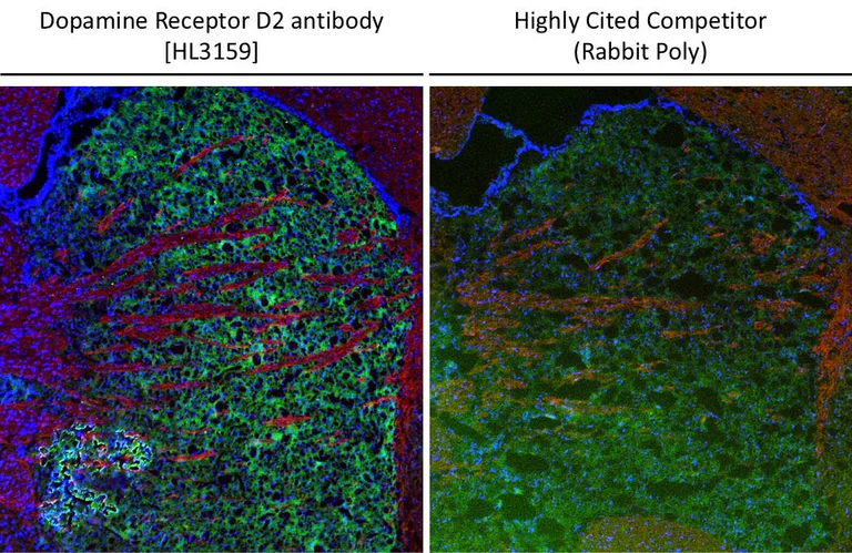 Immunohistochemistry (Frozen sections) - Anti-DRD2 antibody [HL3159] - BSA and Azide free (AB325851)