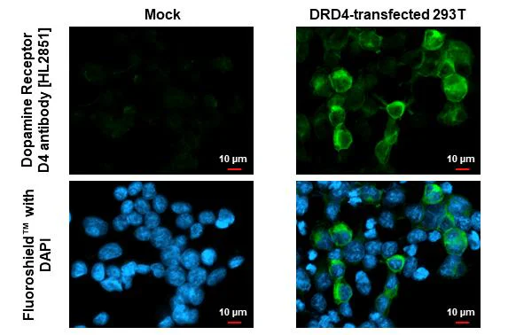Immunocytochemistry/ Immunofluorescence - Anti-DRD4 antibody [HL2851] - BSA and Azide free (AB325852)