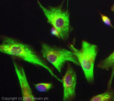 Immunocytochemistry/ Immunofluorescence - Anti-DRD5 antibody (AB32620)