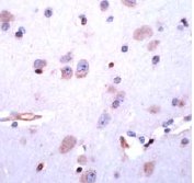 Immunohistochemistry (Formalin/PFA-fixed paraffin-embedded sections) - Anti-DRD5 antibody (AB32620)