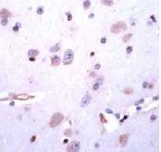 Immunohistochemistry (Formalin/PFA-fixed paraffin-embedded sections) - Anti-DRD5 antibody (AB32620)