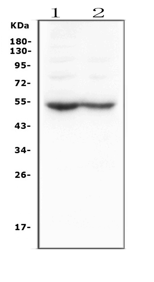 Western blot - Anti-DRD5 antibody - C-terminal (AB181623), expandable thumbnail