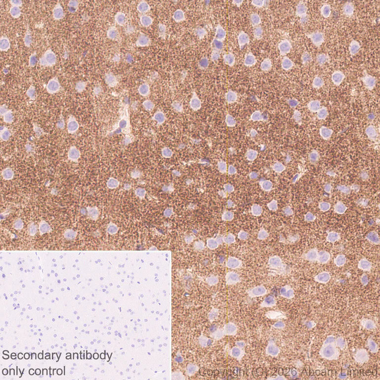 Immunohistochemistry (Formalin/PFA-fixed paraffin-embedded sections) - Anti-DRD5 antibody [EPR30939-63] (AB326718)
