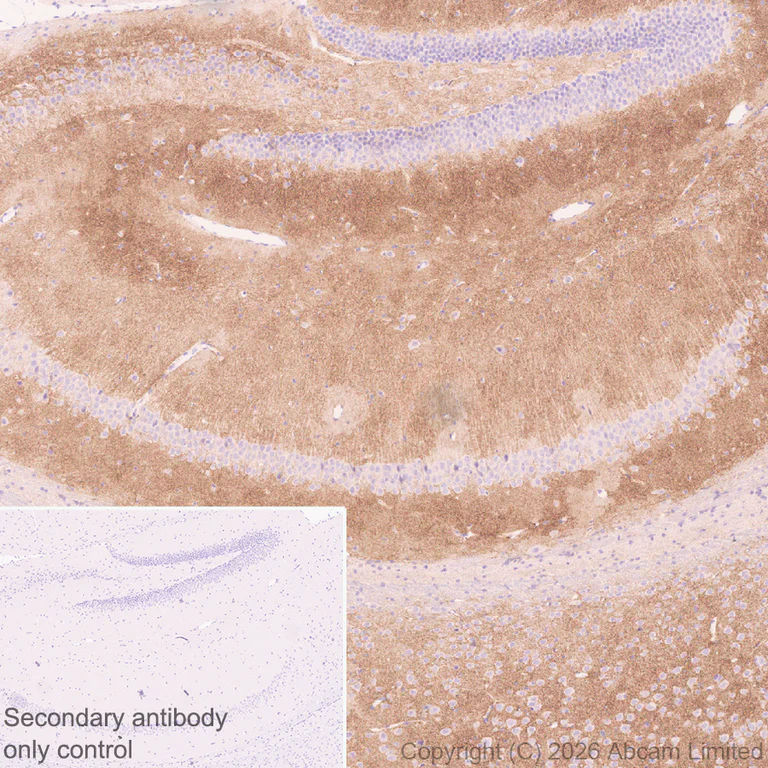 Immunohistochemistry (Formalin/PFA-fixed paraffin-embedded sections) - Anti-DRD5 antibody [EPR30939-63] (AB326718)