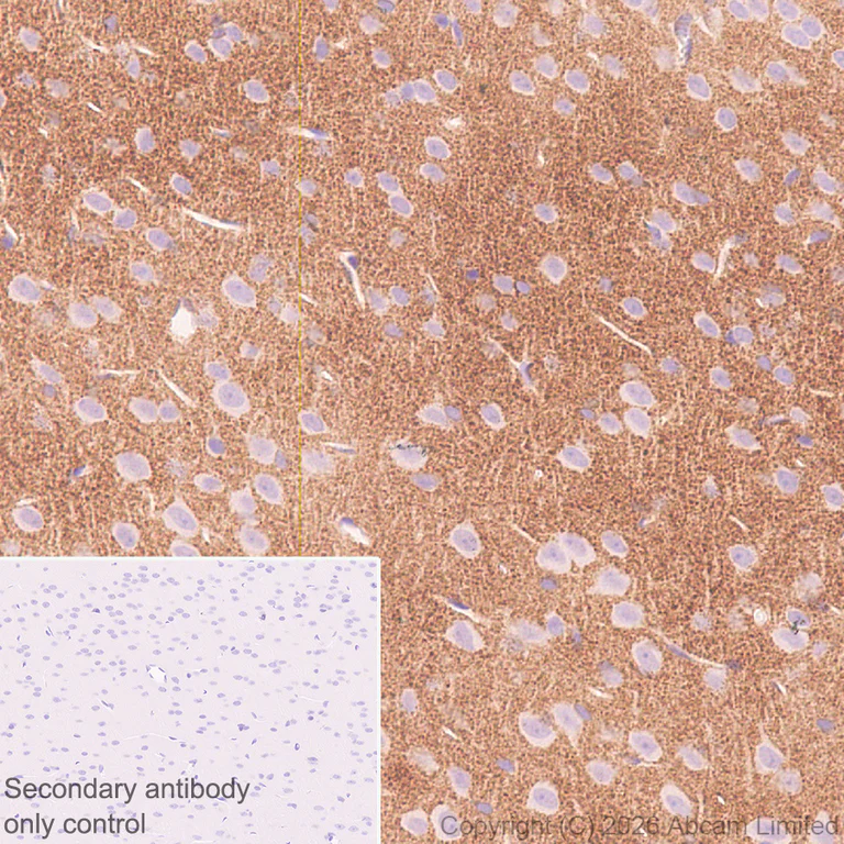 Immunohistochemistry (Formalin/PFA-fixed paraffin-embedded sections) - Anti-DRD5 antibody [EPR30939-63] (AB326718)