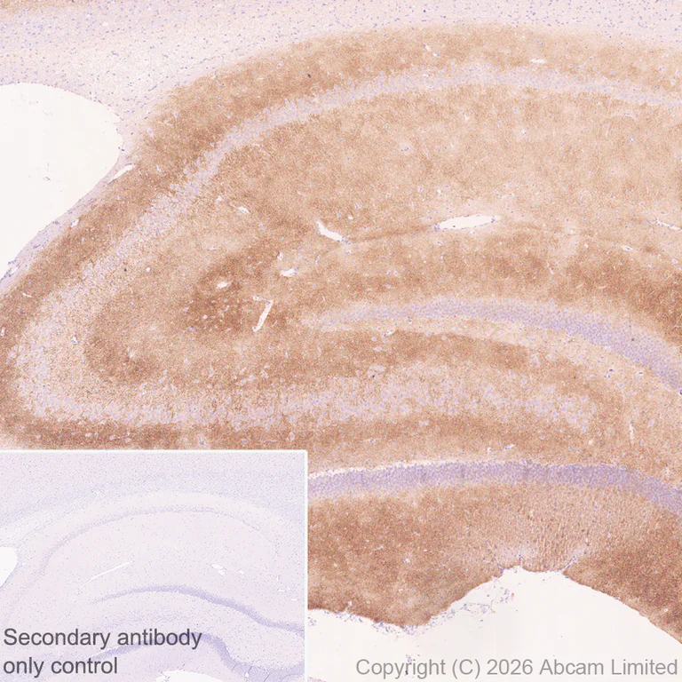 Immunohistochemistry (Formalin/PFA-fixed paraffin-embedded sections) - Anti-DRD5 antibody [EPR30939-63] (AB326718)
