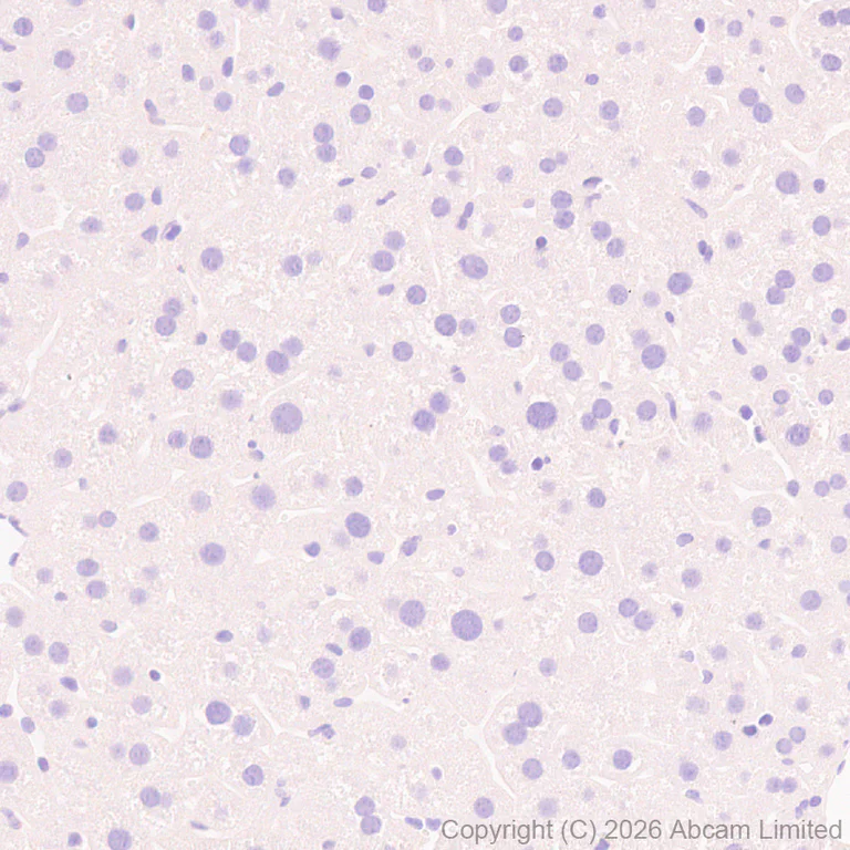 Immunohistochemistry (Formalin/PFA-fixed paraffin-embedded sections) - Anti-DRD5 antibody [EPR30939-63] (AB326718)