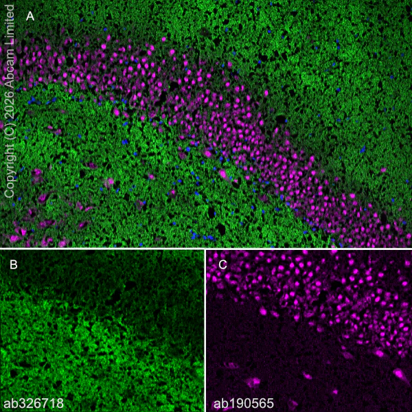Immunohistochemistry (Frozen sections) - Anti-DRD5 antibody [EPR30939-63] (AB326718)
