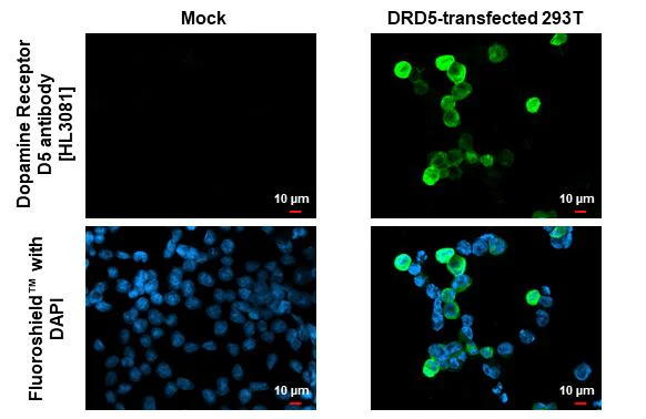 Immunocytochemistry/ Immunofluorescence - Anti-DRD5 antibody [HL3081] - BSA and Azide free (AB325853)