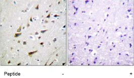 Immunohistochemistry (Formalin/PFA-fixed paraffin-embedded sections) - Anti-DREAM antibody (AB61770)