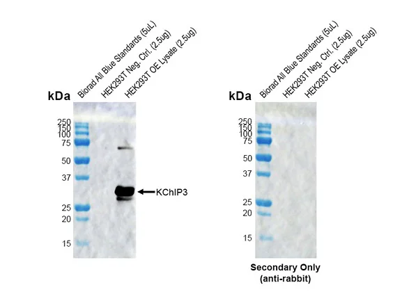 Western blot - Anti-DREAM antibody [X12] (AB326351)