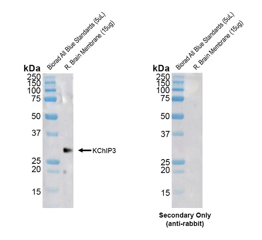 Western blot - Anti-DREAM antibody [X12] (AB326351)