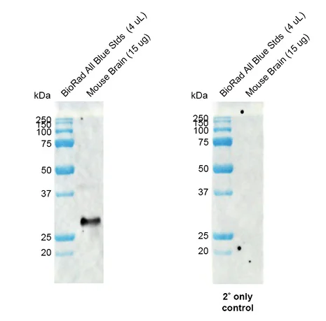 Western blot - Anti-DREAM antibody [X12] (AB326351)