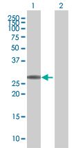 Western blot - DREAM overexpression 293T lysate (whole cell) (AB94275)