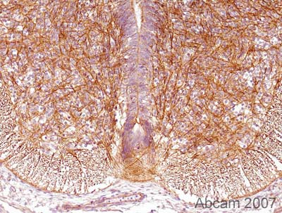 Immunohistochemistry (Formalin/PFA-fixed paraffin-embedded sections) - Anti-Drebrin antibody (AB11068), expandable thumbnail