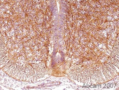 Immunohistochemistry (Formalin/PFA-fixed paraffin-embedded sections) - Anti-Drebrin antibody (AB11068)