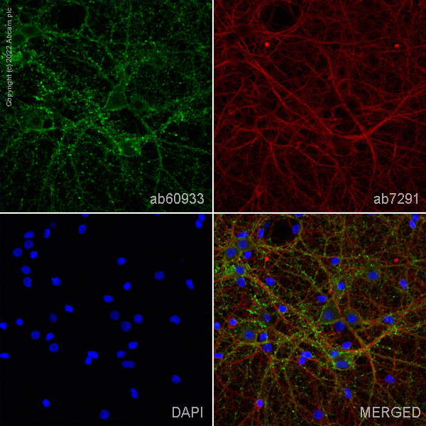 Immunocytochemistry/ Immunofluorescence - Anti-Drebrin antibody (AB60933)