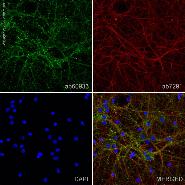 Immunocytochemistry/ Immunofluorescence - Anti-Drebrin antibody (AB60933)
