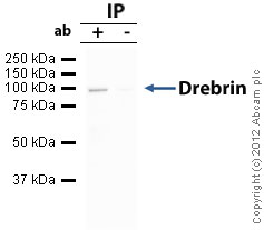 Immunoprecipitation - Anti-Drebrin antibody (AB60933)