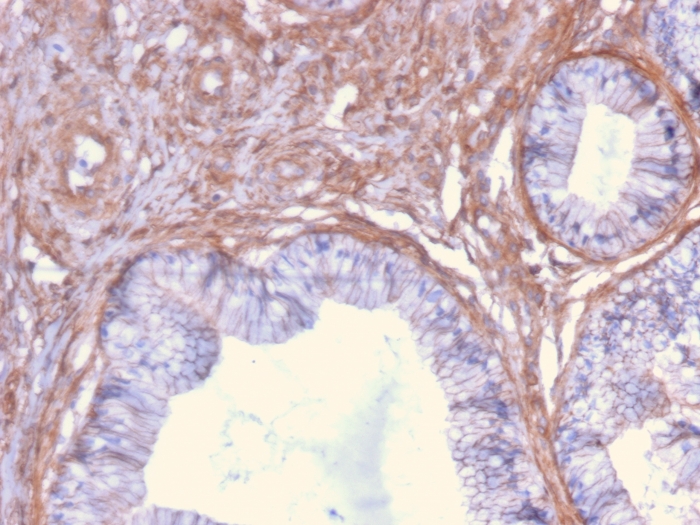 Immunohistochemistry (Formalin/PFA-fixed paraffin-embedded sections) - Anti-Drebrin antibody [DBN1/2879] (AB268046), expandable thumbnail