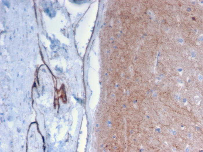 Immunohistochemistry (Formalin/PFA-fixed paraffin-embedded sections) - Anti-Drebrin antibody [DBN1/2879] (AB268046), expandable thumbnail