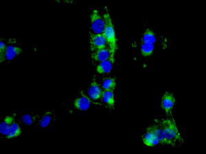 Immunocytochemistry/ Immunofluorescence - Anti-Drebrin antibody [EPR12634] (AB178408), expandable thumbnail