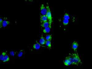 Immunocytochemistry/ Immunofluorescence - Anti-Drebrin antibody [EPR12634] (AB178408)
