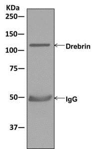 Immunoprecipitation - Anti-Drebrin antibody [EPR12634] (AB178408), expandable thumbnail