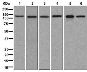 Western blot - Anti-Drebrin antibody [EPR12634] (AB178408), expandable thumbnail