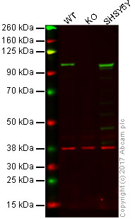Western blot - Anti-Drebrin antibody [EPR12634] (AB178408), expandable thumbnail
