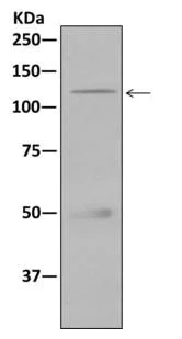 Immunoprecipitation - Anti-Drebrin antibody [EPR12640(B)] (AB176318)
