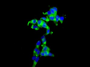 Immunocytochemistry/ Immunofluorescence - Anti-Drebrin antibody [EPR12640(B)] - BSA and Azide free (AB249903)