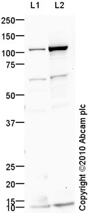 Western blot - Anti-Drebrin antibody [mAbcam60932] (AB60932)