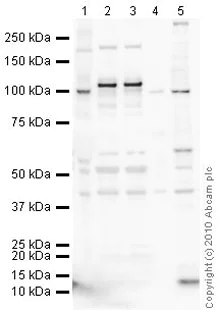Western blot - Anti-Drebrin antibody [mAbcam60932] (AB60932)